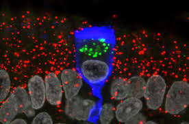 نتیجه جستجوی لغت [infect] در گوگل