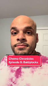 Colby Bald from Chemo