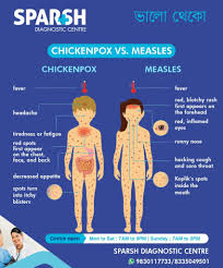 Image result for measles