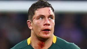 Springboks gain revenge for last year's shock defeat by thrashing Italy