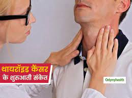 Lung cancer doesn't always cause symptoms in its early stages. 9 Common Signs Of Early Stage Thyroid Cancer In Hindi