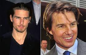 It certainly fits the time period, but it hasn't aged that badly, especially if you just graduated from the police. Tom Cruise Hair Loss How He Stops It Nicehair Org