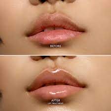 Lip Treatment Hydrating Balm With Squalane - ROSE INC | Sephora
