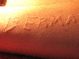 Maybe you would like to learn more about one of these? Phytophotodermatitis Symptoms Treatment And Causes