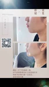 直观比对，美不如真！小姑娘爱死这效果😍