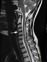 Pin On Mri Scans