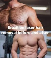 This option leaves women completely bare, but often those who choose brazilian treatments opt to keep some hair in the pubic region, such as a landing. Usalaserhair Bhabad00 Profile Pinterest