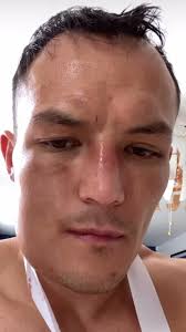 Josh Warrington Provides Injury Update