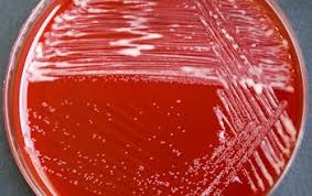 Image result for Rhodococcus equi