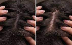 Starting to notice a few grey hairs? How To Hide Gray Hair Without Dye And Things We Shouldn T Do To It