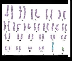 Sex Chromosomes X Linked Inheritance Article Khan Academy