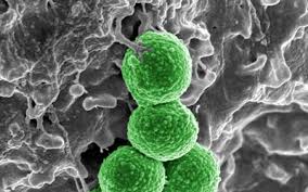 Resultado de imagem para Cientistas descobrem super bactérias que podem extinguir a humanidade