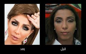 Check spelling or type a new query. ØµÙˆØ± ÙÙ†Ø§Ù†Ø§Øª Ø¹Ø±Ø¨ Ù‚Ø¨Ù„ ÙˆØ¨Ø¹Ø¯ Ø¹Ù…Ù„ÙŠØ§Øª Ø§Ù„ØªØ¬Ù…ÙŠÙ„