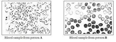 Since the file only includes an answer key with no explanations at all, we offer an extensive and friendly answers & explanations pdf, which you can download via the above button. Biology Paper 2 2020 Kcse Prediction Set 1 Questions And Answers