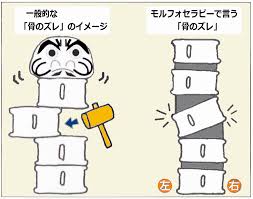 モルフォセラピー｜ちひろ整骨院