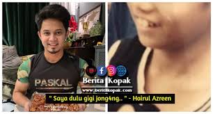 View latest posts and stories by @hairulazreen hairul azreen idris in instagram. Saya Dulu Gigi J0ngang Hairul Azreen Berita Kopak Cc