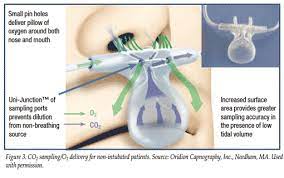 False positive co2 detection — oesophageal intubations after consumption of carbonated beverages or vigorous theatres) — colorimetric co2 detectors may change colour if exposed to acidic fluid (e.g. Clinical Experience With Capnography Monitoring For Pca Patients Anesthesia Patient Safety Foundation