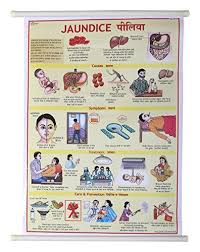 Offerta Di Oggi Vijay Surgical Jaundice Disease Lamination
