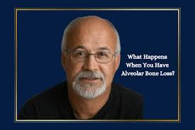 What Happens When You Have Alveolar Bone Loss?