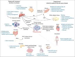 Image result for Cachexia in Cancer