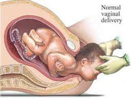 Image result for delivery baby