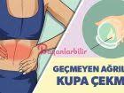 Kupa Terapisinin Sagligimiza Faydasi 2020 Alternatif Saglik Saglik Terapi