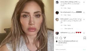 لذا عليك استشارة طبيب اختصاصي التجميل والتحدث معه، ومناقشة عملية شفط الدهون قبل. Ø±ÙŠÙ‡Ø§Ù… Ø³Ø¹ÙŠØ¯ ØªØ«ÙŠØ± Ø§Ù„Ø¬Ø¯Ù„ Ø¨Ù…Ù„Ø§Ù…Ø­ ÙˆØ¬Ù‡Ù‡Ø§ Ù‡Ù„ Ø£Ø¬Ø±Øª Ø¹Ù…Ù„ÙŠØ§Øª ØªØ¬Ù…ÙŠÙ„ Ù‚Ø¨Ù„ Ø¹ÙˆØ¯ØªÙ‡Ø§ Ù„Ù„Ø¥Ø¹Ù„Ø§Ù…