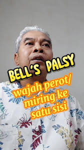 #saraf #neurology #stroke #rsbudiasihcikarang #fyp #infokesehatan #motivasi  #mindset #fisioterapi #CapCut