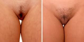 Vulva-Galerie: Schau, welche Unterschiede es gibt! | Vulva-Galerie: Schau,  welche Unterschiede es gibt! | BRAVO