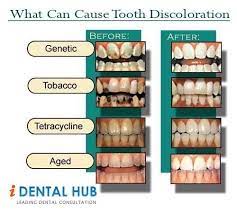 Pin On O Fallon Mo Dentist Dental Health Tips