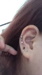 Black Bump Blood Blister On My Piercing What Should I Do I Soaked In Saline Solution Day And Night Daily And I Never Touch It Or Sleep On It