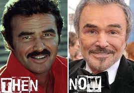 He said that everything that . Burt Reynolds Plastic Surgery Facelift Nose Job Rumor Plastic Surgery Celebrity Plastic Surgery Cosmetic Surgery