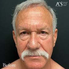 Advanced Cosmetic Surgery (@advancedcosmeticsurgery) • Instagram photos and  videos