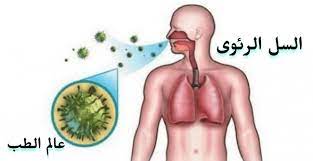 If you stop taking the drugs too soon you can become sick again and potentially spread the disease to others. Ø§Ø¹Ø±Ø§Ø¶ Ø§Ù„Ø³Ù„ Ø§Ù„Ø¨Ø·Ù†ÙŠ Ø£Ø¹Ø±Ø§Ø¶ Ù…Ø±Ø¶ Ø§Ù„Ø³Ù„ Ø§Ù„Ù…Ø¹ÙˆÙŠ