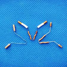 1 for women who can't tolerate hormonal contraception, it can be a godsend. V Shape Intrauterine Copper Iud Releasing Indometacin Buy Copper Iud Releasing Indometacin Intrauterine Copper Iud Releasing Indometacin V Shape Intrauterine Copper Iud Releasing Indometacin Product On Alibaba Com