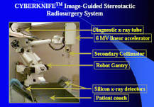 Image result for what source is used for cyberknife radiation treatment