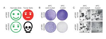 How does colorectal cancer develop? Achilles Heel Of Tumour Cells Universitat Wurzburg
