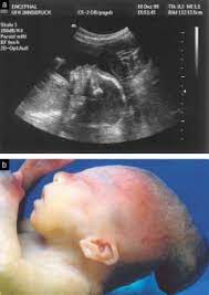 Check spelling or type a new query. Longitudinal Scan At 25 Weeks Gestation Showing The Profile With Download Scientific Diagram
