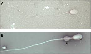 Thus fertilization has restored the diploid number of chromosomes. Frontiers An Autosomal Translocation 73 Xy T 12 20 Q11 Q11 In An Infertile Male Llama Lama Glama With Teratozoospermia Genetics
