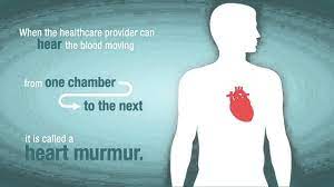 As an experienced cardiologist, dr. Innocent Heart Murmur American Heart Association