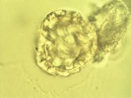 Image result for Brachystegia longifolia