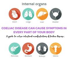 If you have celiac disease, you may have digestive problems or other symptoms. The Symptoms Of Coeliac Disease You Had No Idea About A Balanced Belly