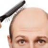 تكلفة زراعة الشعر في تركيا بالريال السعودي help hair loss hair loss natural remedy hair loss cure