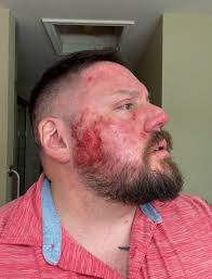 veterans #veteransvoices #ptsdawareness #invisibleinjuries #veteranhealth  #healthcareaccess #disabledveterans #stopthestigma #washingtonpost  #accountability