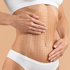 Is Recovery From A Tummy Tuck Painful In Dubai | Price & Cost