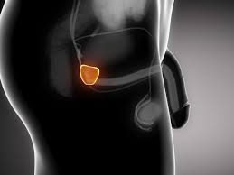 Reviews common tests for these conditions, as well as treatment side effects. Prostata Verkleinerung Auf Die Sanfte Art Wissen