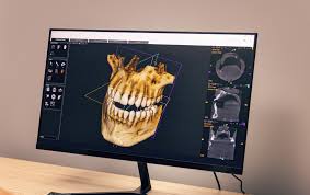 Image result for FDK Multi-11