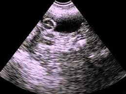 The belly of your dog is big and swollen. Ilmu Pengetahuan 2 6 Week Dog Pregnancy Ultrasound