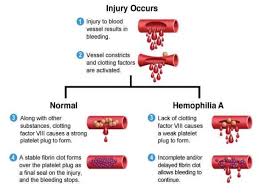 The blood clotting process are vasoconstriction, platelet activation, thrombus formation, and dissolution of the clot. Mechanism Of Clotting