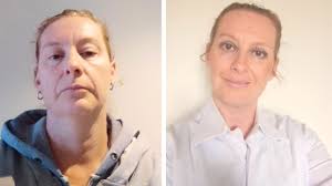 Teratoma: I had a tumour growing hair and teeth; it wanted to be my twin